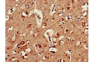 Immunohistochemistry of paraffin-embedded human brain tissue using ABIN7144364 at dilution of 1:100 (AP2M1 antibody  (AA 1-435))