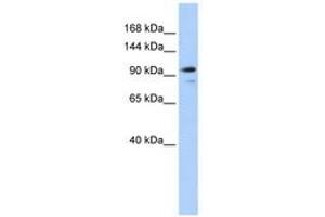 Image no. 1 for anti-Angiomotin Like 1 (AMOTL1) (AA 144-193) antibody (ABIN6740787) (AMOTL1 antibody  (AA 144-193))