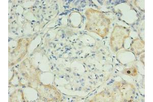 Immunohistochemistry of paraffin-embedded human kidney tissue using ABIN7159947 at dilution of 1:100 (RPUSD4 antibody  (AA 41-240))