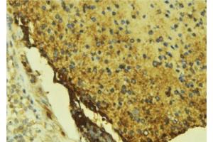 ABIN6276681 at 1/100 staining Mouse liver tissue by IHC-P. (Coagulation Factor X antibody  (C-Term))