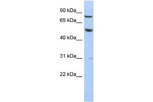 WB Suggested Anti-GPR56 Antibody Titration: 0.