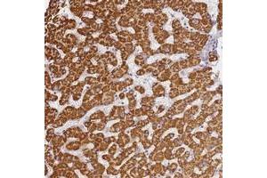 Immunohistochemical staining of human liver with SLC38A9 polyclonal antibody  shows strong cytoplasmic positivity in hepatocytes. (SLC38A9 antibody)