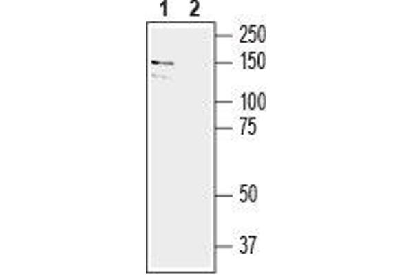 EPH Receptor A6 antibody  (Extracellular, N-Term)