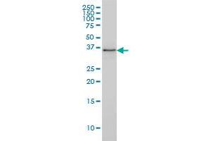 PARVG monoclonal antibody (M01), clone 4E1 Western Blot analysis of PARVG expression in HL-60 . (PARVG antibody  (AA 1-331))