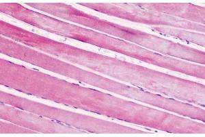 Human, Skeletal muscle: Formalin-Fixed Paraffin-Embedded (FFPE) (CRHR2 antibody  (AA 71-120))