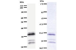 Left: HOXA9 staining. (HOXA9 antibody)