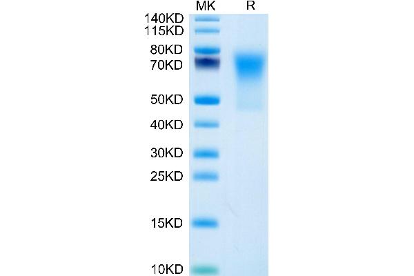 DcR1 Protein (AA 24-236) (His tag)