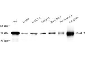 Western blot analysis of SWAP70 (ABIN7075775) at dilution of 1: 2000 (SWAP70 antibody)