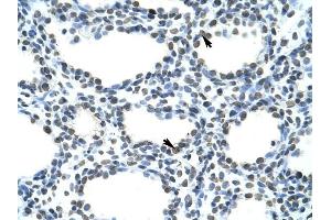 SFRS10 antibody was used for immunohistochemistry at a concentration of 4-8 ug/ml to stain Alveolar cells (arrows) in Human Lung. (TRA2B antibody)