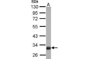 WB Image HMGCL antibody detects HMGCL protein by Western blot analysis. (HMGCL antibody  (full length))