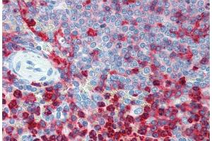 Immunohistochemistry (Paraffin-embedded Sections) (IHC (p)) image for anti-Integrin beta 2 (ITGB2) antibody (ABIN94005)