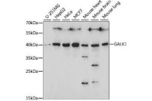 Western blot analysis of extracts of various cell lines, using GALK1 antibody. (GALK1 antibody)