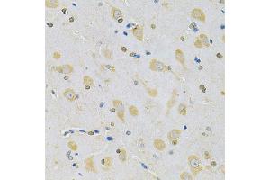 Immunohistochemistry of paraffin-embedded rat brain using CAMK1D Antibody (ABIN5975586) at dilution of 1/100 (40x lens). (CAMK1D antibody)