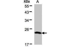 WB Image Sample(30 μg of whole cell lysate) A:H1299 12% SDS PAGE antibody diluted at 1:500 (BTF3 antibody)