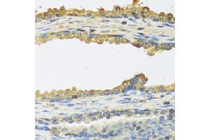 Immunohistochemistry of paraffin-embedded human prostate using TSHB antibody (ABIN6132751, ABIN6149620, ABIN6149621 and ABIN6222522) at dilution of 1:100 (40x lens). (TSHB antibody  (AA 21-138))