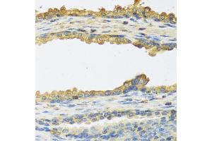 Immunohistochemistry of paraffin-embedded human prostate using TSHB antibody (ABIN6132751, ABIN6149620, ABIN6149621 and ABIN6222522) at dilution of 1:100 (40x lens). (TSHB antibody  (AA 21-138))