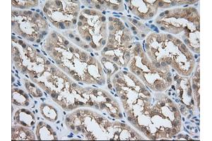 Image no. 4 for anti-Acetyl-CoA Acetyltransferase 2 (ACAT2) antibody (ABIN1496401) (ACAT2 antibody)