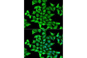 Immunofluorescence analysis of HeLa cell using SEPSECS antibody. (SEPSECS antibody)