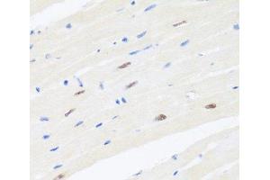 Immunohistochemistry of paraffin-embedded Mouse heart using BRMS1 Polyclonal Antibody at dilution of 1:100 (40x lens). (BRMS1 antibody)