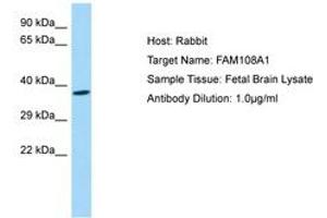 Image no. 1 for anti-Abhydrolase Domain Containing 17A (ABHD17A) (AA 245-294) antibody (ABIN6750194) (ABHD17A antibody  (AA 245-294))