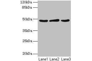 Western blot All lanes: Serpinb2 antibody at 2 μg/mL Lane 1: MCF-7 whole cell lysate Lane 2: 293T whole cell lysate Lane 3: Rat liver tissue Secondary Goat polyclonal to rabbit IgG at 1/10000 dilution Predicted band size: 48 kDa Observed band size: 48 kDa (SERPINB2 antibody  (AA 1-416))