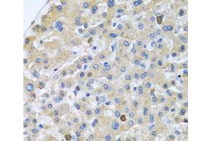 Immunohistochemistry of paraffin-embedded Human liver using APOA5 Polyclonal Antibody at dilution of 1:100 (40x lens). (APOA5 antibody)