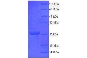 Protease, Serine 2 (PRSS2) (AA 9-231) protein (His tag)