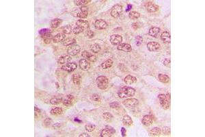 Immunohistochemistry (IHC) image for anti-Cyclin-Dependent Kinase 2 (CDK2) (C-Term) antibody (ABIN7295226)
