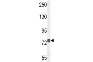 Western Blotting (WB) image for anti-Choline O-Acetyltransferase (CHAT) (AA 98-128) antibody (ABIN3028569)
