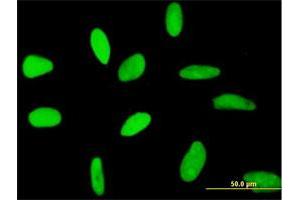 Immunofluorescence of purified MaxPab antibody to RECQL on HeLa cell. (RecQ Protein-Like (DNA Helicase Q1-Like) (RECQL) (AA 1-649) antibody)