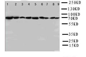 Lane 9: COLO320 Cell Lysate (Hsc70 antibody  (N-Term))
