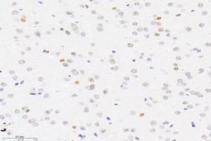 Immunohistochemistry analysis of paraffin-embedded mouse brain using,PLK5 (ABIN7075111) at dilution of 1: 4000 (PLK5 antibody)