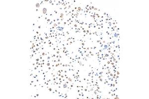 Immunocytochemistry (ICC) image for anti-SMAD Family Member 4 (SMAD4) (AA 1-50) antibody (ABIN7455159)
