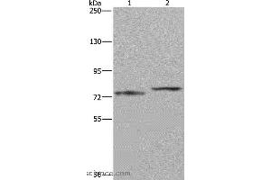 Western blot analysis of Mouse heart tissue and 231 cell, using AATF Polyclonal Antibody at dilution of 1:667 (AATF antibody)