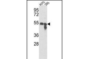 Western blot analysis of Tyrosinase Antibody (Center) (ABIN391521 and ABIN2841481) in , 293 cell line lysates (35 μg/lane). (TYR antibody  (AA 176-205))