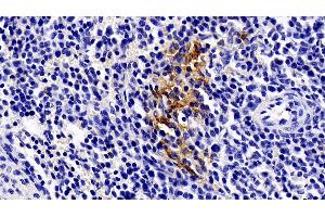 Immunohistochemistry (IHC) image for anti-Fas (TNFRSF6)-Associated Via Death Domain (FADD) (AA 12-206) antibody (ABIN7439960)
