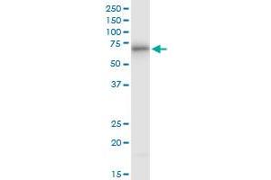 ATE1 monoclonal antibody (M01), clone 2B6. (ATE1 antibody  (AA 1-87))