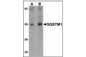 Western blot analysis of SQSTM1 in Human spleen tissue lysate with SQSTM1 antibody at (A) 1 and (B) 2 µg/ml.
