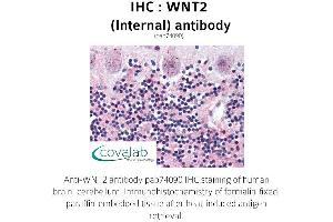 Image no. 1 for anti-Wingless-Type MMTV Integration Site Family Member 2 (WNT2) (Internal Region) antibody (ABIN1740825) (WNT2 antibody  (Internal Region))