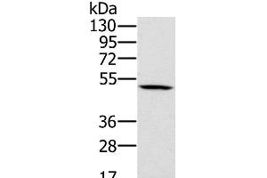 Western Blot analysis of 231 cell using PSMC2 Polyclonal Antibody at dilution of 1:500 (PSMC2 antibody)
