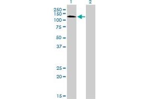 Western Blot analysis of RNF111 expression in transfected 293T cell line by RNF111 monoclonal antibody (M05), clone 1C4. (RNF111 antibody  (AA 1-108))