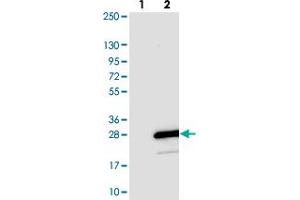 Western blot analysis of Lane 1: Negative control (vector only transfected HEK293T lysate). (TOMM20L antibody)