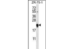 GAGE12H Antibody (N-term) (ABIN657560 and ABIN2846567) western blot analysis in ZR-75-1 cell line lysates (35 μg/lane). (G Antigen 12H antibody  (N-Term))