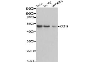 Western blot analysis of extracts of various cell lines, using KRT17 antibody. (KRT17 antibody)