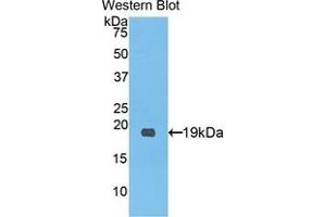 Detection of Recombinant PCPE1, Human using Polyclonal Antibody to Procollagen C-Endopeptidase Enhancer (PCOLCE) (PCOLCE antibody  (AA 315-437))