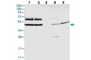 Western blot analysis of Lane 1: RT-4, Lane 2: U-251 MG, Lane 3: Human Plasma, Lane 4: Liver, Lane 5: Tonsil with G3BP2 polyclonal antibody  at 1:250-1:500 dilution. (G3BP2 antibody)