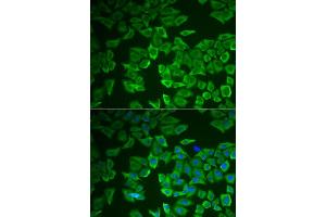 Immunofluorescence analysis of HeLa cells using CRHBP antibody (ABIN6129571, ABIN6139030, ABIN6139033 and ABIN6222243). (CRHBP antibody  (AA 25-322))