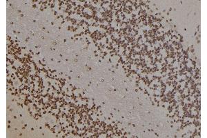 ABIN6277453 at 1/100 staining Rat brain tissue by IHC-P. (PARP1 antibody  (Internal Region))