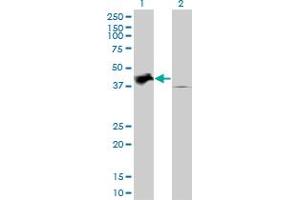 Western Blotting (WB) image for anti-Tribbles Pseudokinase 2 (TRIB2) (AA 254-344) antibody (ABIN599226) (TRIB2 antibody  (AA 254-344))
