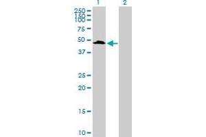 Western Blot analysis of UIMC1 expression in transfected 293T cell line by UIMC1 MaxPab polyclonal antibody. (UIMC1 antibody  (AA 1-385))